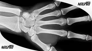 I BROKE MY HAND FOR REAL 🥵