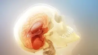 Сотрясение мозга