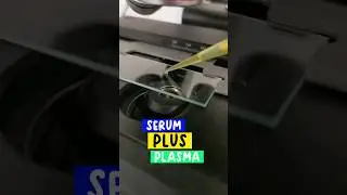 liquid portion of blood (serum and plasma) under the microscope 