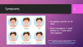 Rubella video