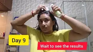 Rosemary water for hair growth | 15 days challenge| real results| #review