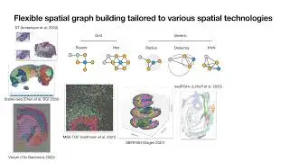 08 Spatial Transcriptomics analysis with Squidpy