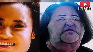 أبشع عمليات التجميل التى انتهت بنتائج كارثية ؟! oops