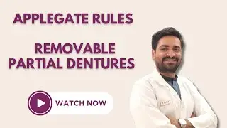 APPLE GATE RULES FOR REMOVABLE PARTIAL DENTURES : A COMPREHENSIVE GUIDE