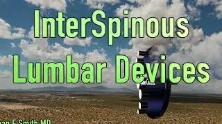 InterSpinous Devices