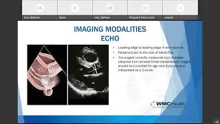 20220210 Aortopathy in Marfan Syndrome and Related Conditions.