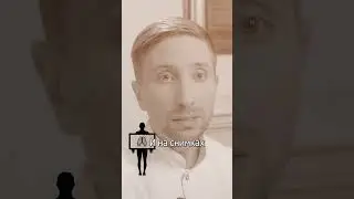 ☝ Синус лифтинг: что подсаживают в гайморову пазуху? 18+