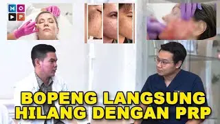 BOPENG LANGSUNG HILANG DENGAN PRP| OKDOKTER