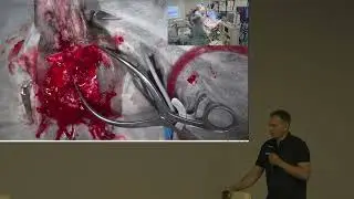 Почему не лечится средний отит  Как вылечить средний отит