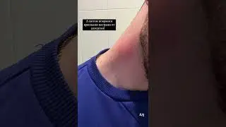 😱 У ЭДИСОНА МАЙНКРАФТ АЛЛЕРГИЯ - СТОРИС 