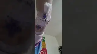 poppers = sepsis and death