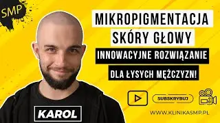 MIKROPIGMENTACJA SKÓRY GŁOWY - Innowacyjne rozwiązanie dla łysych mężczyzn! KLINIKA SMP!