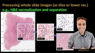 267 - Processing whole slide images (as tiles)