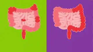 What Is Inflammatory Bowel Disease (IBD) | Connecticut Children's