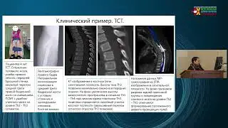16.02.2022  Актуальные вопросы реабилитации детей с острыми травматическими повреждениями