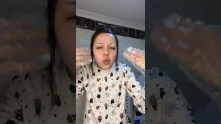 Kaşlarımı açtım | yüzüm yandı | çok korkunç bir haldeyim | sakın siz yapmayın