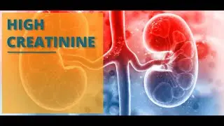 Control Your Creatinine Levels with These 5 Best Foods