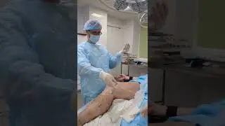 Лечение варикоза лазером наглядно 