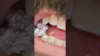 Металл, который можно жевать! 