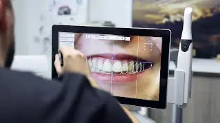 3Shape Gülüş Tasarımı Kullanıcı Arayüzü -  Smile Design User Interface
