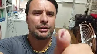 Заживление раны на Осциляторе