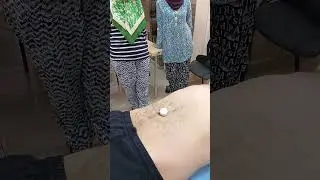 Постановка пиявки в правке живота. Гирудотерапия