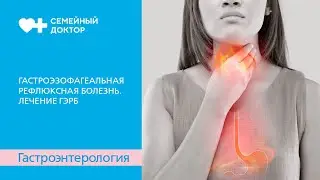 Гастроэзофагеальная рефлюксная болезнь. Лечение ГЭРБ