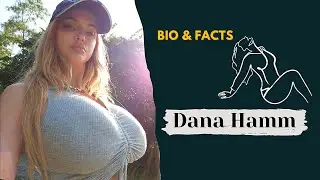 Dana Hamm | American Plus Size Model |Fashion Model & Instagram Star|Bio,Facts,Lifestyle,Career