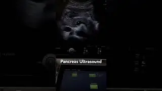 Pancreas Ultrasound | Normal Structures