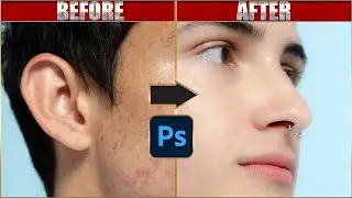 How To Make  High-End Skin Retouching in Photoshop 2024 II 