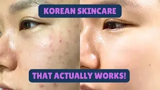 Riman Korean Skincare Exceeds Expectations, here’s why?