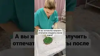ОТПЕЧАТОК ПЛАЦЕНТЫ 