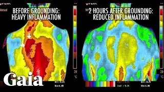 This is How EARTHING Reduces INFLAMMATION in the Body