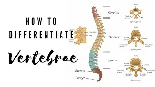How to differentiate Vertebrae | Viva Voce of Anatomy