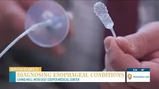 VIDEO: Living Well: Diagnosing Esophageal Conditions