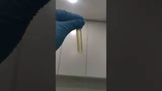 Turbid urine 