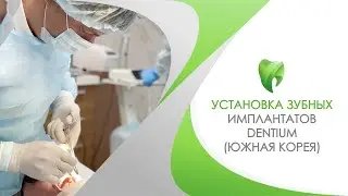 Имплантация зубов в Сочи. Установка имплантата Dentium (Южная Корея)