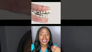 How to stub tongue thrusting and thumb sucking 