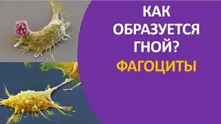 28. Как образуется гной? Фагоциты