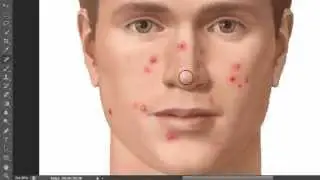 Photoshop Sivilce - Siyah Nokta - Cildi Prüssüzleştirmek