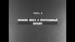 Диафильм Психиатрия  6  Сифилис мозга и прогрессивный паралич