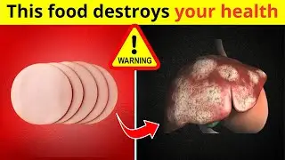 10 WORST Foods That Are Destroying Your HEALTH! (Must-Watch Guide)