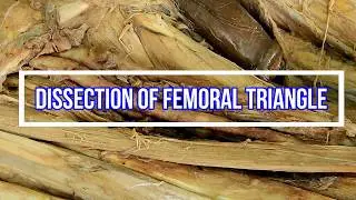 Dissection of Femoral Triangle