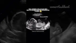 МАЛУМОТ УЧУН ФАКАТ ТЕЛЕГРАМДАН ЁЗИНГ: +998950014004 