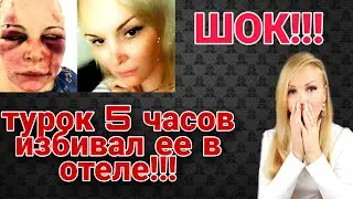 Шок ! / Турция отказалась защищать женщин от домашнего насилия ? / Жертвы насилия в Турции