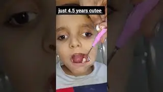 only 4.5 years cutee boy having tooth pain - problem solved 😊👍 