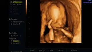 video 1038130864