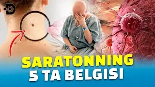 УШБУ АЛОМАТЛАРНИ ЭЪТИБОРСИЗ ҚОЛДИРМАНГ! САРАТОННИНГ 5 БЕЛГИСИ!