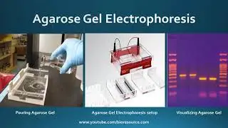 Gel Electrophoresis and Types of Gel Electrophoresis