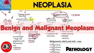 Benign and Malignant Neoplasm - Neoplasia | Pathology